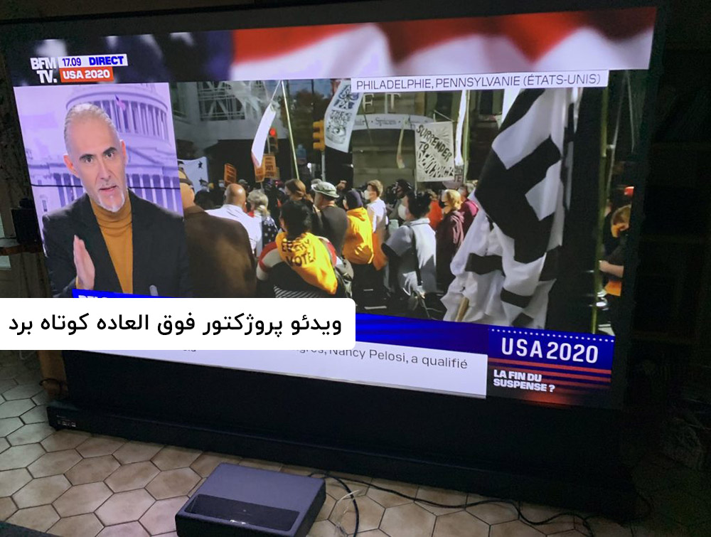 فناوری اولترا شورت ترو
